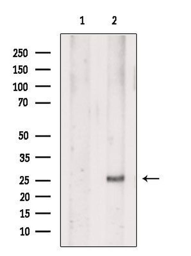 EVI2A Antibody in Western Blot (WB)