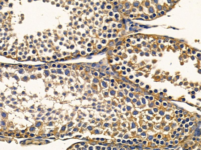 EXPH5 Antibody in Immunohistochemistry (Paraffin) (IHC (P))