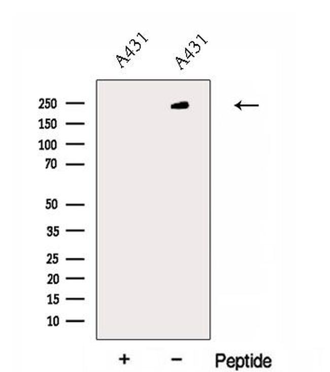 EXPH5 Antibody in Western Blot (WB)