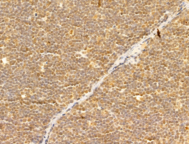 FMN2 Antibody in Immunohistochemistry (Paraffin) (IHC (P))