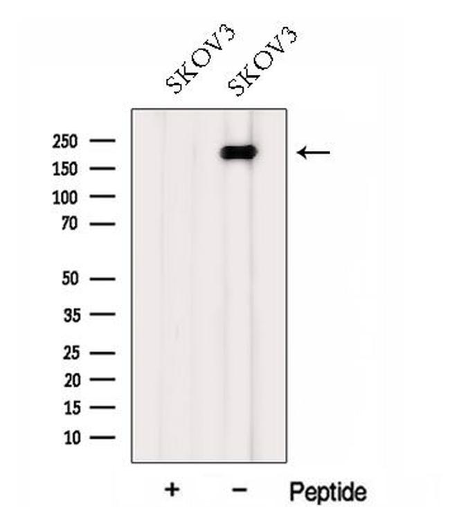 FMN2 Antibody in Western Blot (WB)