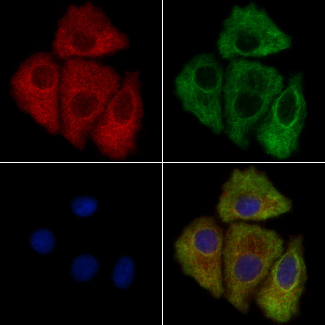 FKTN Antibody in Immunocytochemistry (ICC/IF)