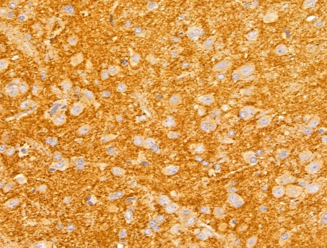 FKTN Antibody in Immunohistochemistry (Paraffin) (IHC (P))