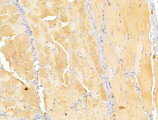 FKTN Antibody in Immunohistochemistry (Paraffin) (IHC (P))