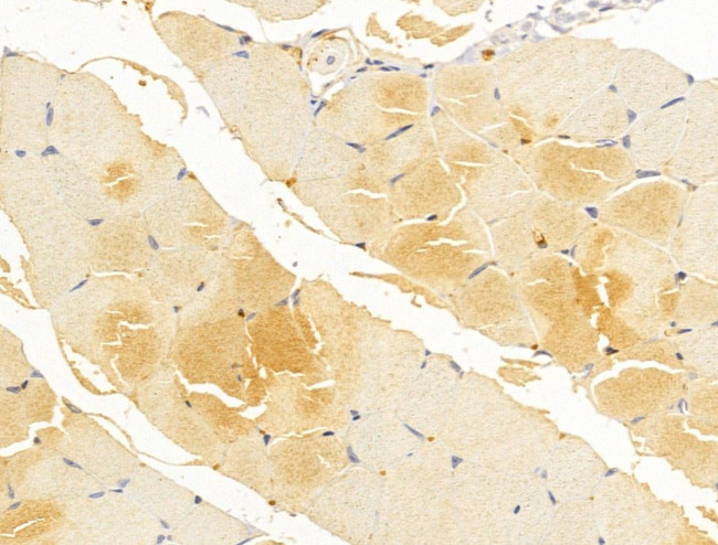 FKTN Antibody in Immunohistochemistry (Paraffin) (IHC (P))