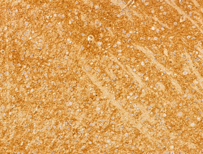 FKTN Antibody in Immunohistochemistry (Paraffin) (IHC (P))