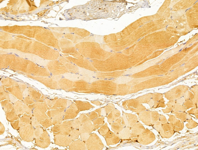 FKTN Antibody in Immunohistochemistry (Paraffin) (IHC (P))