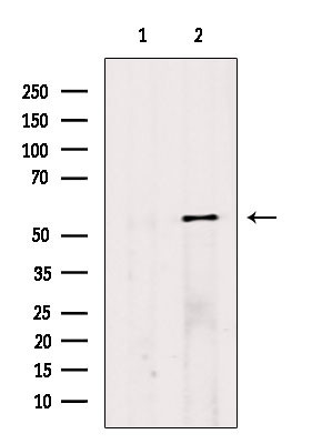 FKTN Antibody in Western Blot (WB)