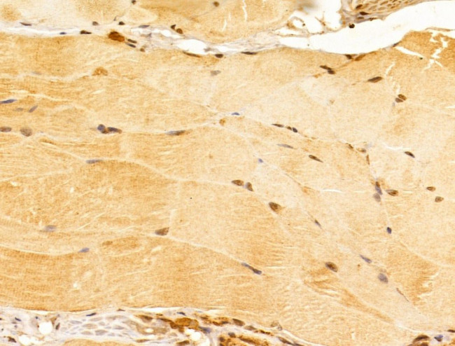 FZR1 Antibody in Immunohistochemistry (Paraffin) (IHC (P))