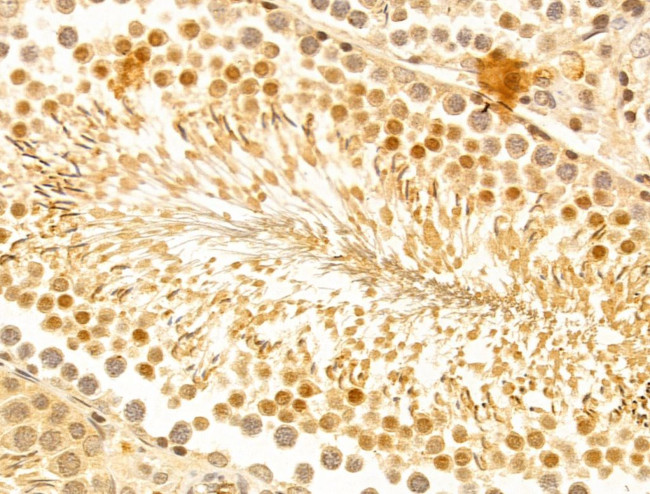 FZR1 Antibody in Immunohistochemistry (Paraffin) (IHC (P))