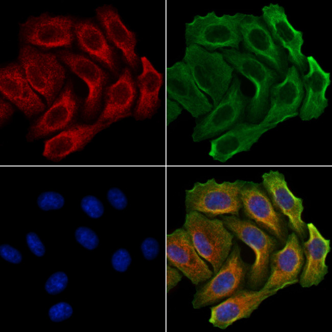 GALNT14 Antibody in Immunocytochemistry (ICC/IF)