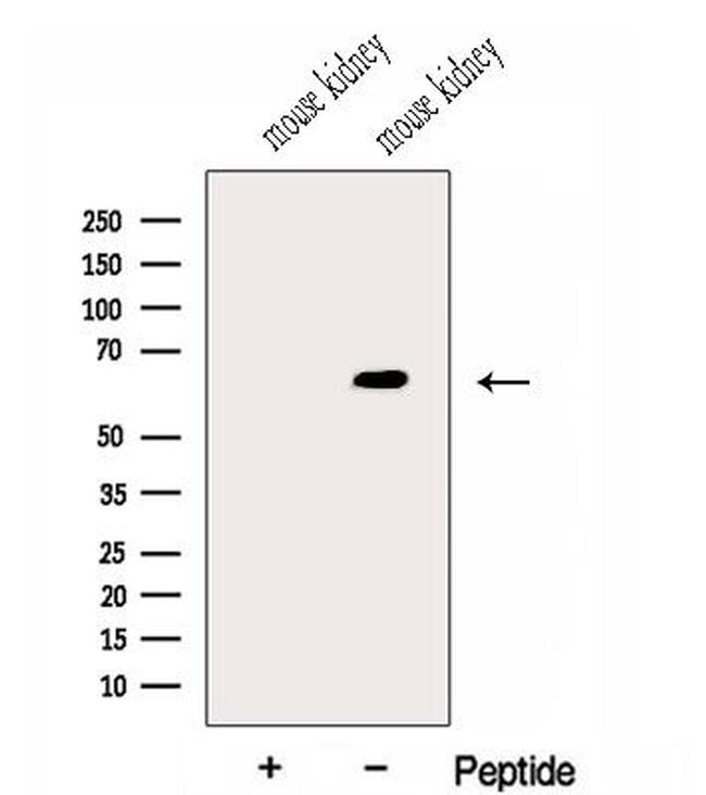 GALNT14 Antibody in Western Blot (WB)