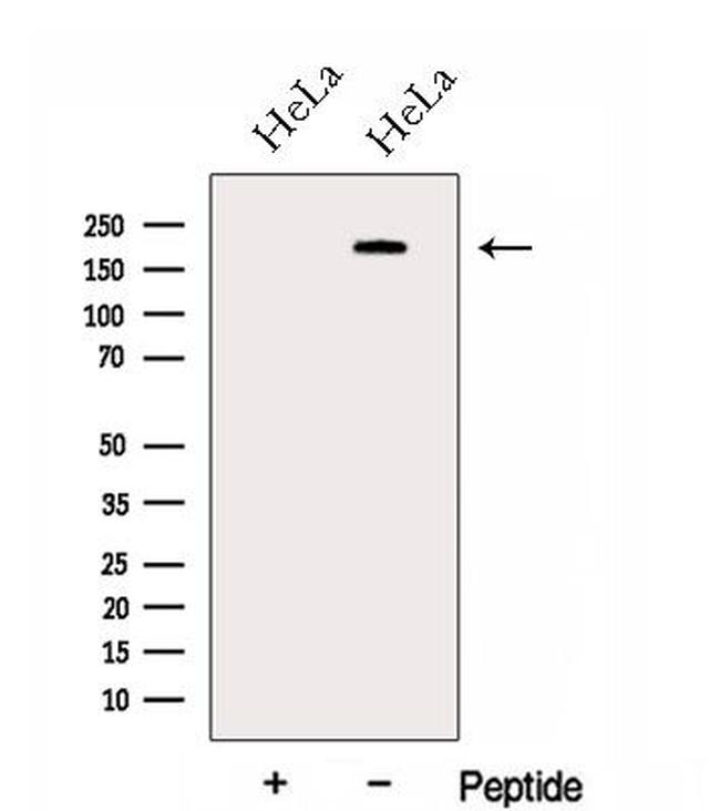 GBF1 Antibody in Western Blot (WB)