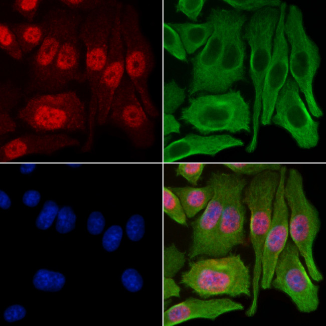 GCHFR Antibody in Immunocytochemistry (ICC/IF)