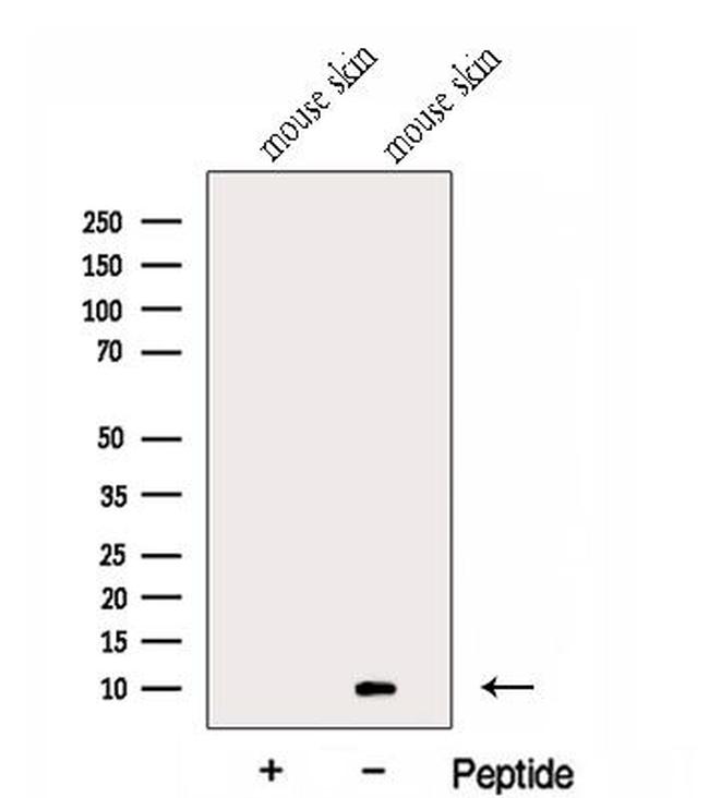 GCHFR Antibody in Western Blot (WB)