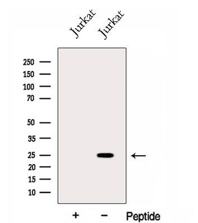 GINS3 Antibody in Western Blot (WB)