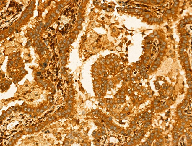 GLTP Antibody in Immunohistochemistry (Paraffin) (IHC (P))