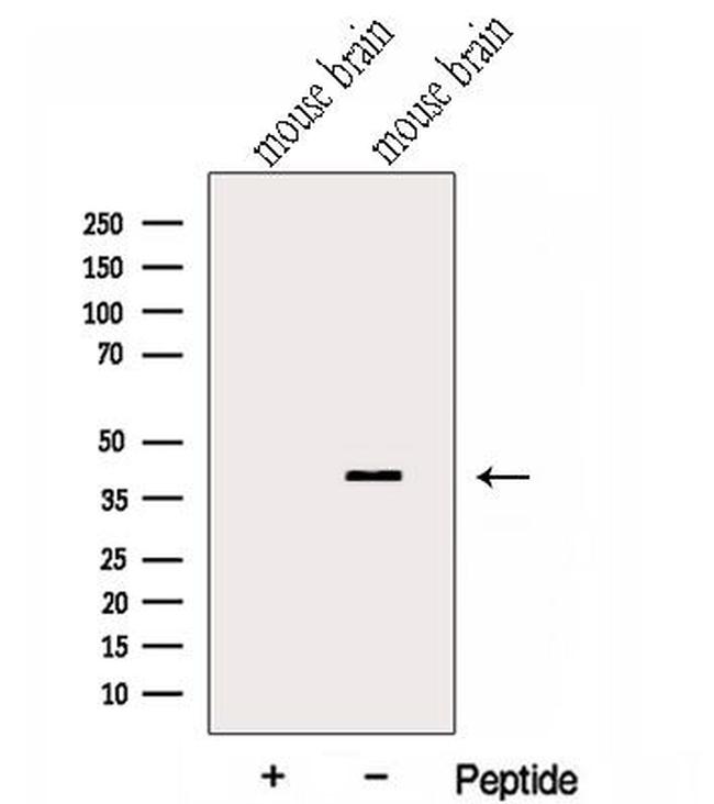 GNAI2 Antibody in Western Blot (WB)