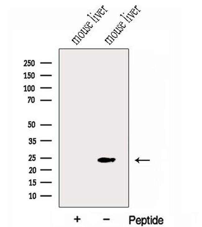 GNPNAT1 Antibody in Western Blot (WB)