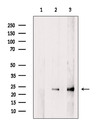 GNPNAT1 Antibody in Western Blot (WB)