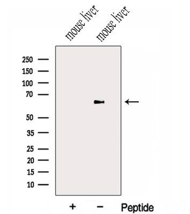 HAS3 Antibody in Western Blot (WB)