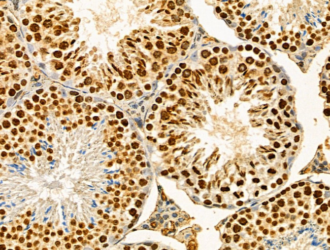 HEPH Antibody in Immunohistochemistry (Paraffin) (IHC (P))