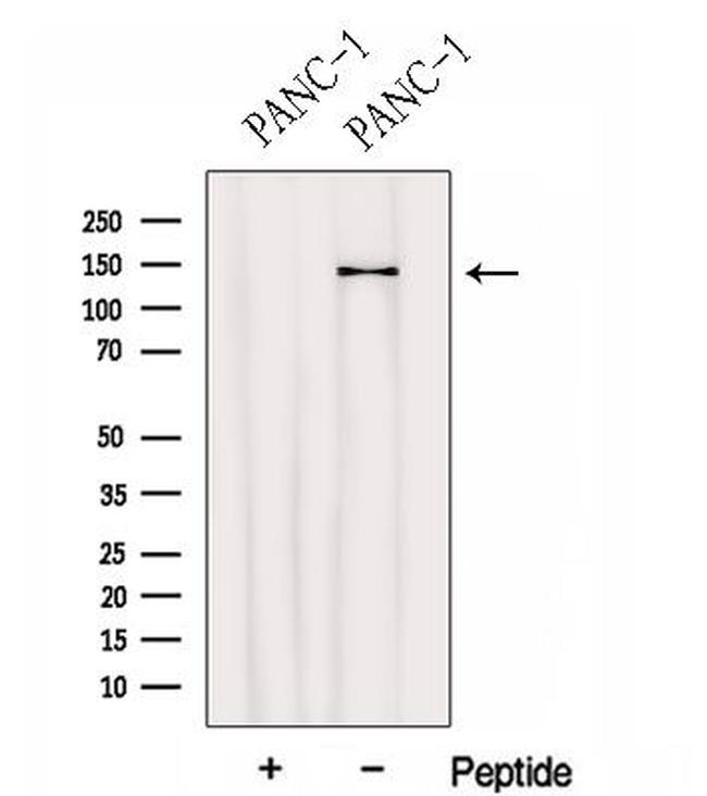 HEPH Antibody in Western Blot (WB)