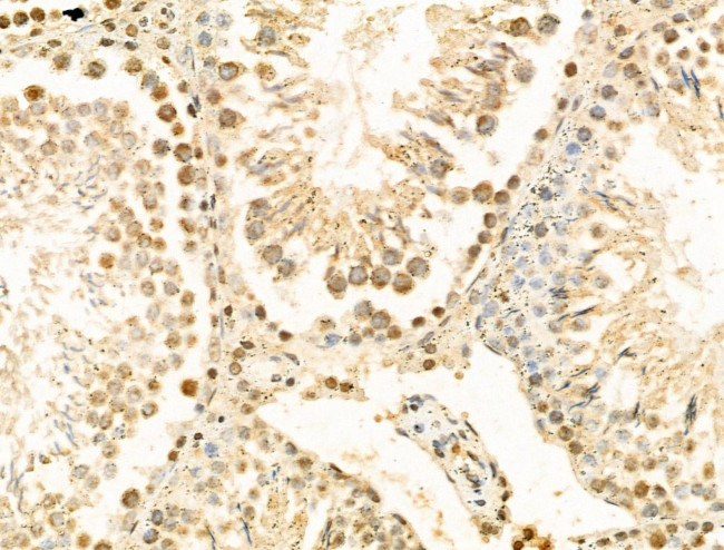 HERC5 Antibody in Immunohistochemistry (Paraffin) (IHC (P))