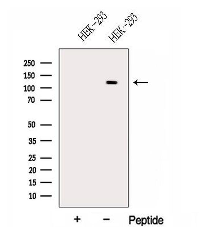 HERC5 Antibody in Western Blot (WB)