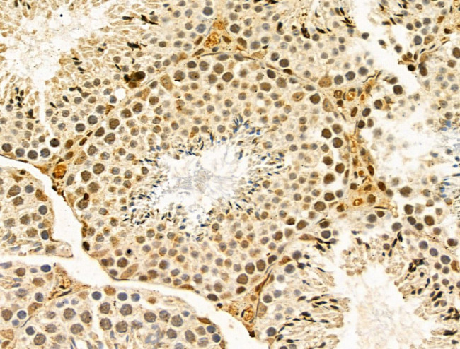 hnRNP R Antibody in Immunohistochemistry (Paraffin) (IHC (P))