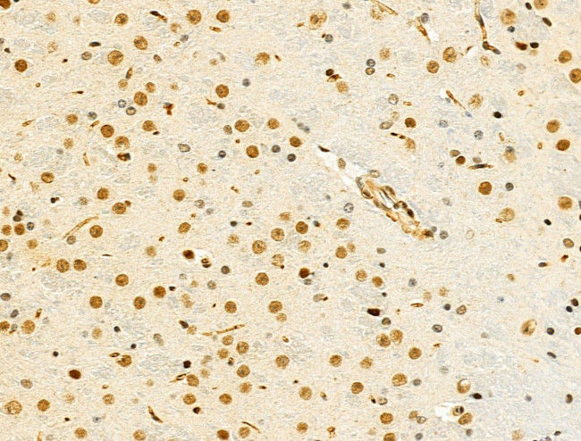 hnRNP R Antibody in Immunohistochemistry (Paraffin) (IHC (P))