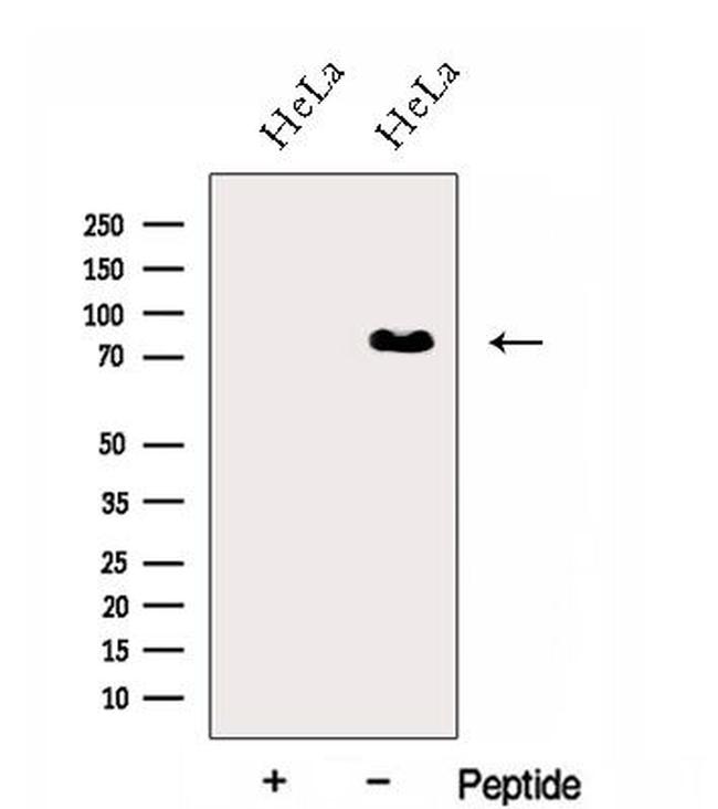 hnRNP R Antibody in Western Blot (WB)