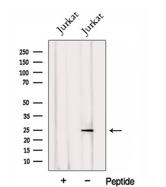 PSMC3IP Antibody in Western Blot (WB)