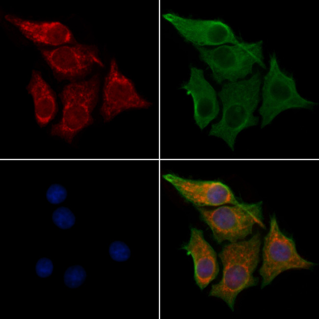 IDI1 Antibody in Immunocytochemistry (ICC/IF)