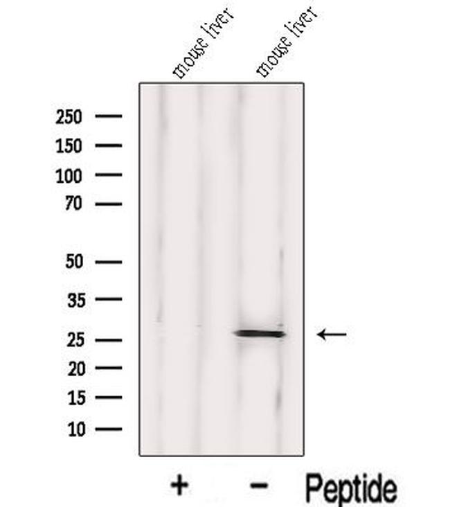 IDI1 Antibody in Western Blot (WB)