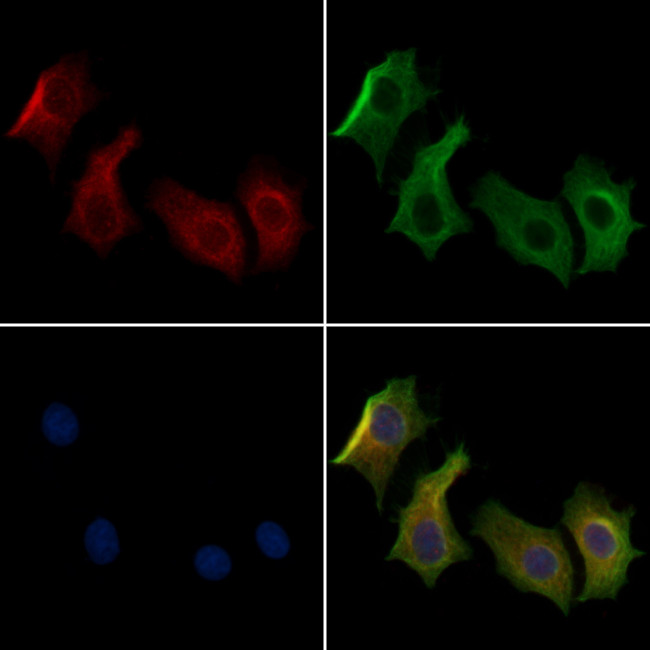 IFT122 Antibody in Immunocytochemistry (ICC/IF)