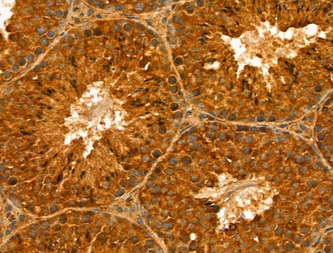 RABL4 Antibody in Immunohistochemistry (Paraffin) (IHC (P))