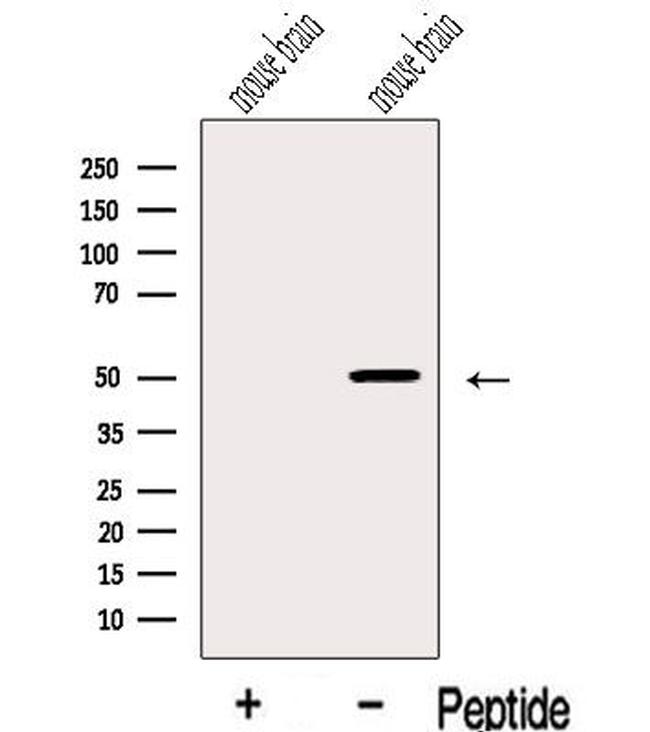 IGSF21 Antibody in Western Blot (WB)