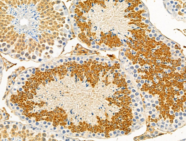 IL17RE Antibody in Immunohistochemistry (Paraffin) (IHC (P))