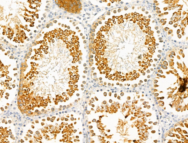 IL17RE Antibody in Immunohistochemistry (Paraffin) (IHC (P))