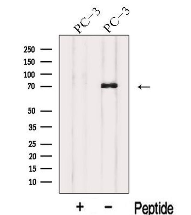 IL17RE Antibody in Western Blot (WB)