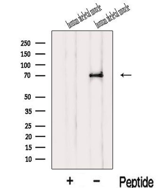 IL1RAPL1 Antibody in Western Blot (WB)