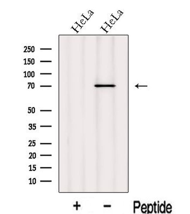 INPP5B Antibody in Western Blot (WB)