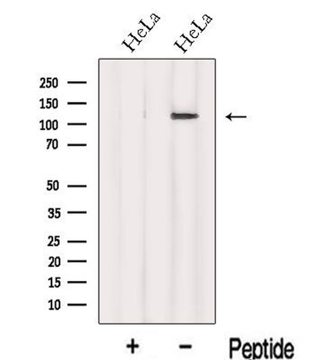 INTS8 Antibody in Western Blot (WB)