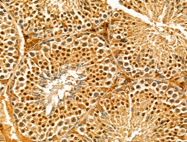 IWS1 Antibody in Immunohistochemistry (Paraffin) (IHC (P))