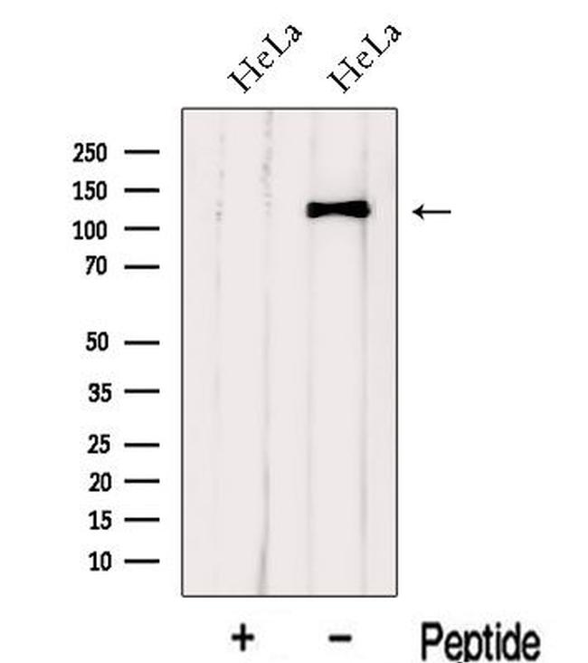 IWS1 Antibody in Western Blot (WB)