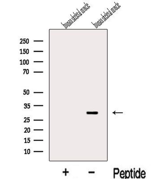 KCNE4 Antibody in Western Blot (WB)