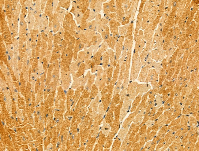 KIAA1033 Antibody in Immunohistochemistry (Paraffin) (IHC (P))