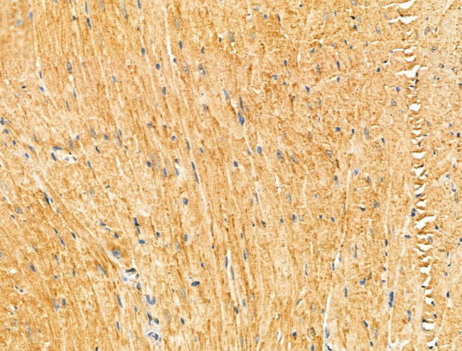 KIF19 Antibody in Immunohistochemistry (Paraffin) (IHC (P))