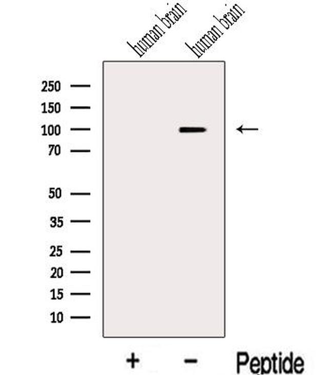 KIF19 Antibody in Western Blot (WB)